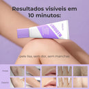 Velure - Creme de Dissolução Capilar Que Dissolve o Pelo Abaixo da Pele e Deixa a Pele Lisa em 10 Minutos