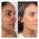 PeelFusion – Kit Esfoliante Coreano 2 em 1 Que Desobstrui Poros e Uniformiza a Pele Sem Irritar